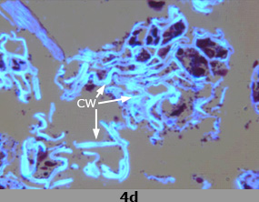 4d. Scanning electron micrograph images of fibre-rich fraction with components labeled - enlarged.